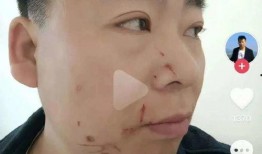 爆料网红明星接吻视频在线观看,网红明星激情接吻视频在线观看，瞬间引爆网络热议！